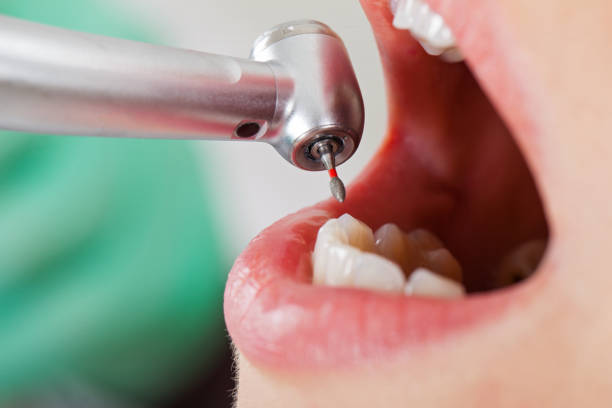 Best Emergency Cosmetic Dentistry (e.g., broken veneers) in Norton, VA